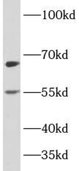 PLAGL2 Rabbit Polyclonal Antibody