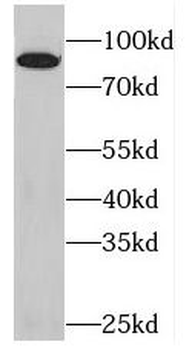 PKP3 Rabbit Polyclonal Antibody