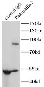 PKP3 Rabbit Polyclonal Antibody