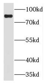 PLCD3 Rabbit Polyclonal Antibody