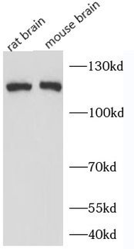 PLCL2 Rabbit Polyclonal Antibody