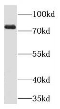 PLD1 Rabbit Polyclonal Antibody