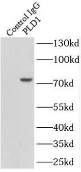 PLD1 Rabbit Polyclonal Antibody