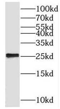 BLOC1S6 Rabbit Polyclonal Antibody