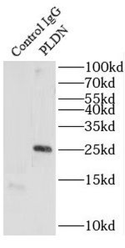BLOC1S6 Rabbit Polyclonal Antibody
