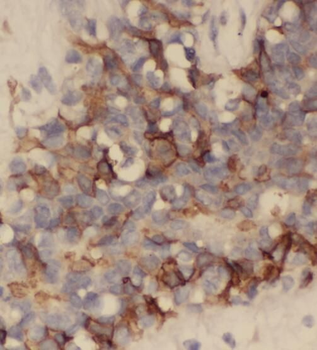 BLOC1S6 Rabbit Polyclonal Antibody