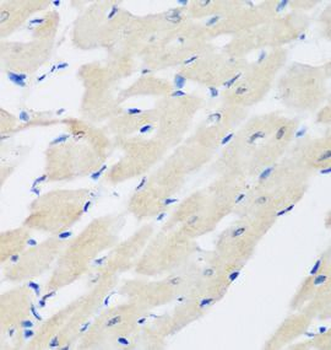 PLEK Rabbit Polyclonal Antibody