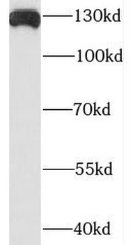 PLEKHA5 Rabbit Polyclonal Antibody
