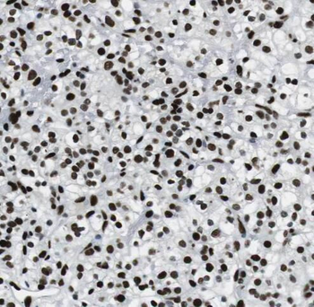 PLEKHA8 Rabbit Polyclonal Antibody