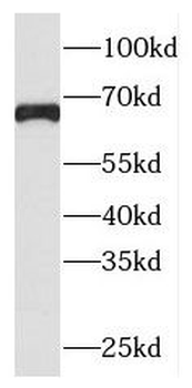 PLEKHA8P1 Rabbit Polyclonal Antibody
