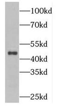 PLEKHO1 Rabbit Polyclonal Antibody