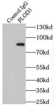PLOD3 Rabbit Polyclonal Antibody