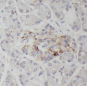 PLOD3 Rabbit Polyclonal Antibody