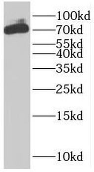 PLS1 Rabbit Polyclonal Antibody