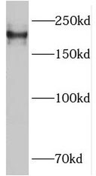 PLXNB1 Rabbit Polyclonal Antibody