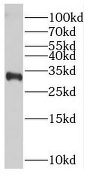 PMEPA1 Rabbit Polyclonal Antibody