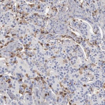 PMEPA1 Rabbit Polyclonal Antibody