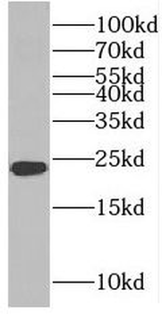 PMF1 Rabbit Polyclonal Antibody