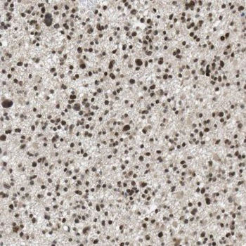 PMF1 Rabbit Polyclonal Antibody
