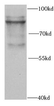 PML Rabbit Polyclonal Antibody