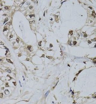 PML Rabbit Polyclonal Antibody