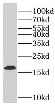 PMP2 Rabbit Polyclonal Antibody