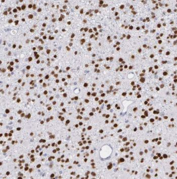 PMP2 Rabbit Polyclonal Antibody