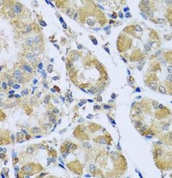 PMPCB Rabbit Polyclonal Antibody
