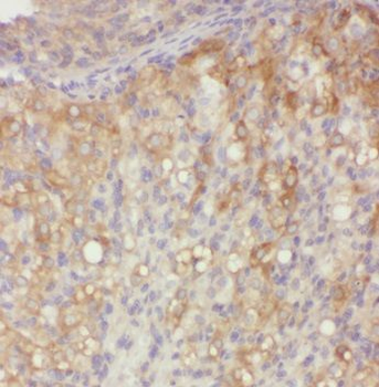 PNCK Rabbit Polyclonal Antibody