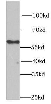 PNKP Rabbit Polyclonal Antibody