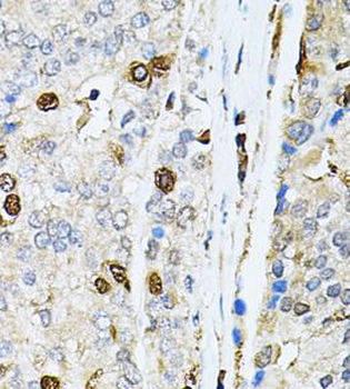 PNKP Rabbit Polyclonal Antibody