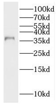 PNMA1 Rabbit Polyclonal Antibody