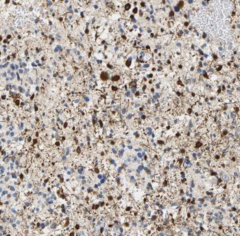 PNMA1 Rabbit Polyclonal Antibody
