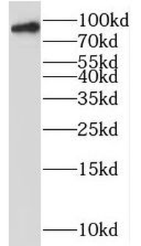 PNPT1 Rabbit Polyclonal Antibody