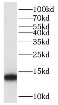 POLR2J Rabbit Polyclonal Antibody