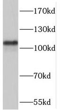 PKD2 Rabbit Polyclonal Antibody