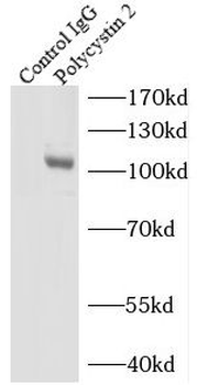 PKD2 Rabbit Polyclonal Antibody