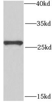 POP4 Rabbit Polyclonal Antibody