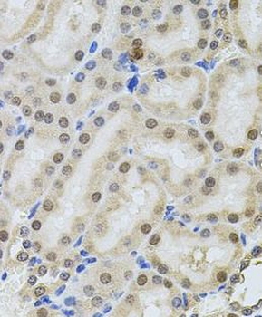 POP4 Rabbit Polyclonal Antibody