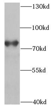 POT1 Rabbit Polyclonal Antibody