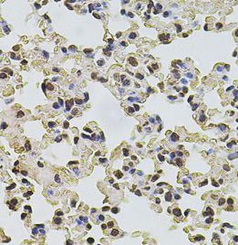 POT1 Rabbit Polyclonal Antibody