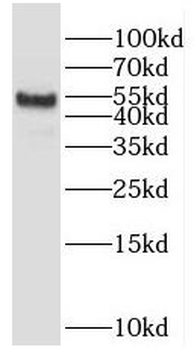 POTEA Rabbit Polyclonal Antibody
