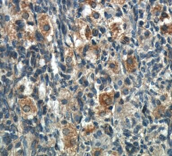 POTEA Rabbit Polyclonal Antibody