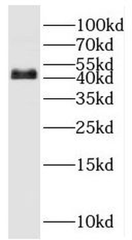POU3F4 Rabbit Polyclonal Antibody