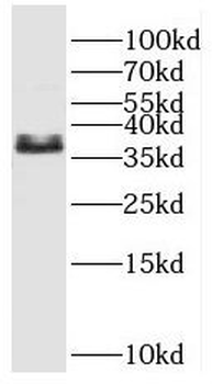 ENDOU Rabbit Polyclonal Antibody