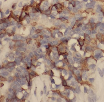 ENDOU Rabbit Polyclonal Antibody