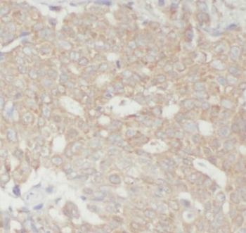 PPA1 Rabbit Polyclonal Antibody