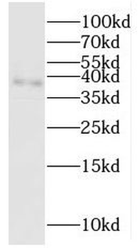 PPA2 Rabbit Polyclonal Antibody