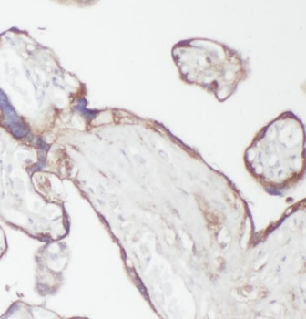 PPA2 Rabbit Polyclonal Antibody