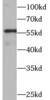 PPARG Rabbit Polyclonal Antibody